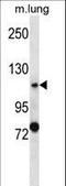 Polycystin 2, Transient Receptor Potential Cation Channel antibody, LS-C163746, Lifespan Biosciences, Western Blot image 