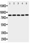 X-Ray Repair Cross Complementing 5 antibody, PA1641, Boster Biological Technology, Western Blot image 