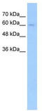 Transforming Growth Factor Beta Receptor 2 antibody, TA335780, Origene, Western Blot image 