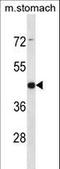 Arrestin Domain Containing 1 antibody, LS-C156514, Lifespan Biosciences, Western Blot image 