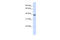 Ras Association Domain Family Member 7 antibody, 27-138, ProSci, Western Blot image 