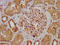 Alanine--Glyoxylate Aminotransferase 2 antibody, LS-C672294, Lifespan Biosciences, Immunohistochemistry paraffin image 