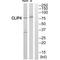 CAP-Gly Domain Containing Linker Protein Family Member 4 antibody, A11447, Boster Biological Technology, Western Blot image 