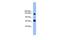 Pleckstrin Homology And RhoGEF Domain Containing G2 antibody, PA5-45008, Invitrogen Antibodies, Western Blot image 