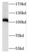 SIX Homeobox 5 antibody, FNab07889, FineTest, Western Blot image 