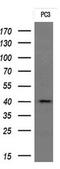 Transmembrane Protein 173 antibody, MA5-26029, Invitrogen Antibodies, Western Blot image 