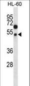 Forkhead Box A2 antibody, LS-C166213, Lifespan Biosciences, Western Blot image 