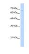 Transketolase Like 2 antibody, NBP1-55173, Novus Biologicals, Western Blot image 