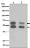 Calcium/Calmodulin Dependent Protein Kinase II Beta antibody, M03964, Boster Biological Technology, Western Blot image 
