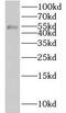 Kelch Domain Containing 3 antibody, FNab04606, FineTest, Western Blot image 