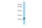 Spindlin Family Member 2A antibody, PA5-70756, Invitrogen Antibodies, Western Blot image 