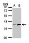 Serine Protease 8 antibody, GTX103976, GeneTex, Western Blot image 
