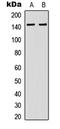 Diacylglycerol Kinase Kappa antibody, LS-C358962, Lifespan Biosciences, Western Blot image 