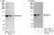 RNA Binding Motif Protein 12 antibody, A301-198A, Bethyl Labs, Western Blot image 