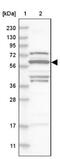 Splicing Factor 3a Subunit 3 antibody, NBP1-87212, Novus Biologicals, Western Blot image 