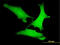Axin 1 antibody, LS-C198545, Lifespan Biosciences, Immunofluorescence image 