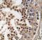 Cyclin Dependent Kinase 14 antibody, LS-C99915, Lifespan Biosciences, Immunohistochemistry paraffin image 