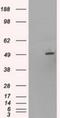 One Cut Homeobox 1 antibody, NBP1-47903, Novus Biologicals, Western Blot image 
