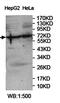 Ubiquitin Specific Peptidase 22 antibody, orb78183, Biorbyt, Western Blot image 