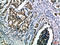Interleukin 15 antibody, STJ99006, St John