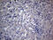 DIRAS Family GTPase 2 antibody, M15333, Boster Biological Technology, Immunohistochemistry paraffin image 