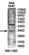 Zinc Finger Protein 625 antibody, orb78144, Biorbyt, Western Blot image 