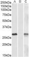 Deltex E3 Ubiquitin Ligase 3 antibody, 42-249, ProSci, Western Blot image 