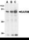 Sterile Alpha And TIR Motif Containing 1 antibody, AHP870, Bio-Rad (formerly AbD Serotec) , Western Blot image 