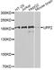 UPF2 Regulator Of Nonsense Mediated MRNA Decay antibody, STJ29171, St John