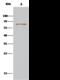 Serum Response Factor Binding Protein 1 antibody, 14461-T36, Sino Biological, Immunoprecipitation image 