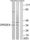 Olfactory Receptor Family 52 Subfamily E Member 4 antibody, GTX87361, GeneTex, Western Blot image 