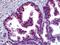 MutS Homolog 6 antibody, orb94394, Biorbyt, Immunohistochemistry paraffin image 
