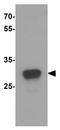 Interleukin 15 Receptor Subunit Alpha antibody, GTX31523, GeneTex, Western Blot image 