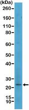 MART1 antibody, NBP2-77413, Novus Biologicals, Western Blot image 