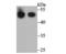 Betaine--Homocysteine S-Methyltransferase antibody, NBP2-75418, Novus Biologicals, Western Blot image 