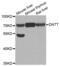 DNA Nucleotidylexotransferase antibody, abx004776, Abbexa, Western Blot image 