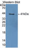 ArfGAP With Dual PH Domains 2 antibody, LS-C374843, Lifespan Biosciences, Western Blot image 