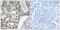 Zinc Finger MYM-Type Containing 4 antibody, A11190, Boster Biological Technology, Immunohistochemistry paraffin image 