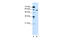 Oxysterol Binding Protein Like 9 antibody, 30-091, ProSci, Western Blot image 