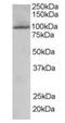 Serine/threonine-protein kinase TAO3 antibody, orb18876, Biorbyt, Western Blot image 