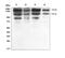 Adenosine Deaminase RNA Specific antibody, PB9976, Boster Biological Technology, Western Blot image 