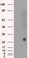 Peroxiredoxin 4 antibody, M05000, Boster Biological Technology, Western Blot image 