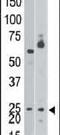 BCL2 Interacting Protein 3 antibody, PA5-11402, Invitrogen Antibodies, Western Blot image 
