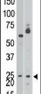 BCL2 Interacting Protein 3 antibody, PA5-11402, Invitrogen Antibodies, Western Blot image 