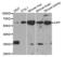 Complement Factor Properdin antibody, abx004133, Abbexa, Western Blot image 