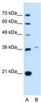 LIM Homeobox 8 antibody, TA342389, Origene, Western Blot image 