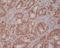 Phosphoinositide-3-Kinase Regulatory Subunit 2 antibody, M03363, Boster Biological Technology, Immunohistochemistry frozen image 