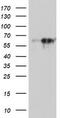 Monoamine Oxidase A antibody, M03326, Boster Biological Technology, Western Blot image 