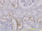 Solute Carrier Family 25 Member 11 antibody, LS-C133546, Lifespan Biosciences, Immunohistochemistry paraffin image 