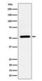 Adrenoceptor Alpha 1A antibody, M02110, Boster Biological Technology, Western Blot image 